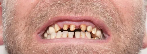 Choosing a dental clinic in Turkey