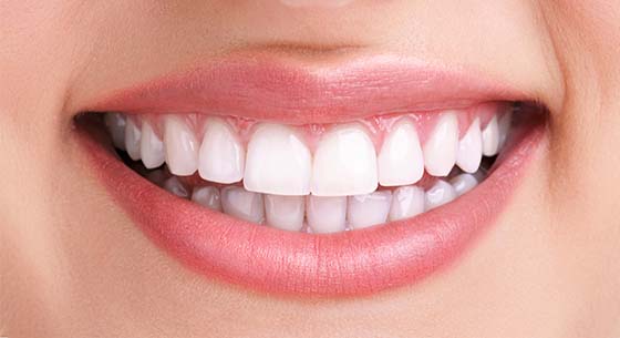 Things About Teeth Whitening